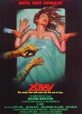 Ακτίνα θανάτου / Hospital Massacre / X-Ray (1981)